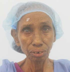 patient Image